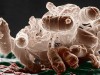 La presencia de la bacteria E.coli tiene relación directa con la cadena de producción y preparación de los alimentos.