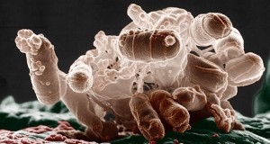 La presencia de la bacteria E.coli tiene relación directa con la cadena de producción y preparación de los alimentos.