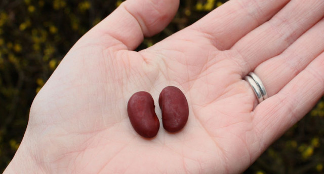 Claves para cuidar los riñones eliminando sustancias nocivas de la dieta