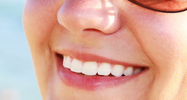 sonrisa-dientes