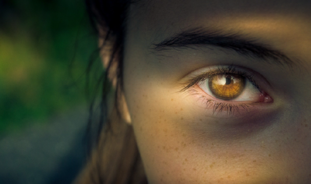 ojeras